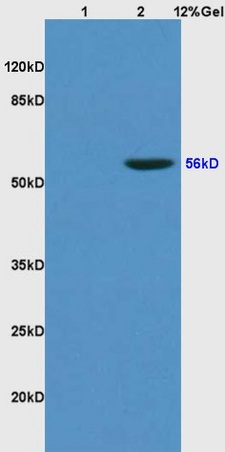 L1 rat kidney lysates L2 human colon carcinoma lysates probed with Anti KLF4 Polyclonal Antibody, Unconjugated (bs-1064R) at 1:200 overnight at 4˚C. Followed by conjugation to secondary antibody (bs-0295G-HRP) at 1:3000 for 90 min at 37˚C. Predicted band 56kD. Observed band size: 56kD. L1 rat kidney lysates L2 human colon carcinoma lysates probed with Anti KLF4 Polyclonal Antibody, Unconjugated (bs-1064R) at 1:200 overnight at 4˚C. Followed by conjugation to secondary antibody (bs-0295G-HRP) at 1:3000 for 90 min at 37˚C. Predicted band 56kD. Observed band size: 56kD.