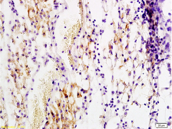 Formalin-fixed and paraffin embedded rat transplant lymphoma labeled with Anti-PDGF-B Polyclonal Antibody, Unconjugated (bs-0185R) at 1:200 followed by conjugation to the secondary antibody and DAB staining