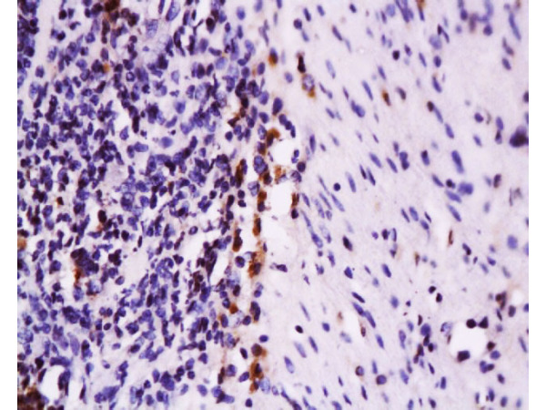 Formalin-fixed and paraffin embedded rat colon tissue labeled with Anti-Fas Polyclonal Antibody, Unconjugated (bs-0215R) at 1:200 followed by conjugation to the secondary antibody and DAB staining