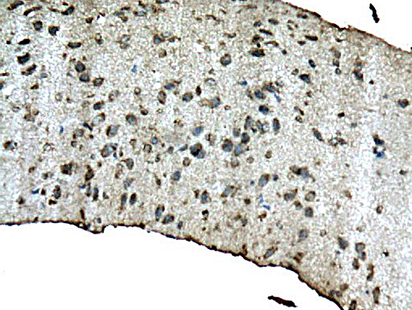 Formalin-fixed and paraffin embedded mouse hippocampus labeled with Anti-B-Amyloid 1-42(CT) Polyclonal Antibody, Unconjugated (bs-0076M), followed by conjugation to the secondary antibody and DAB staining