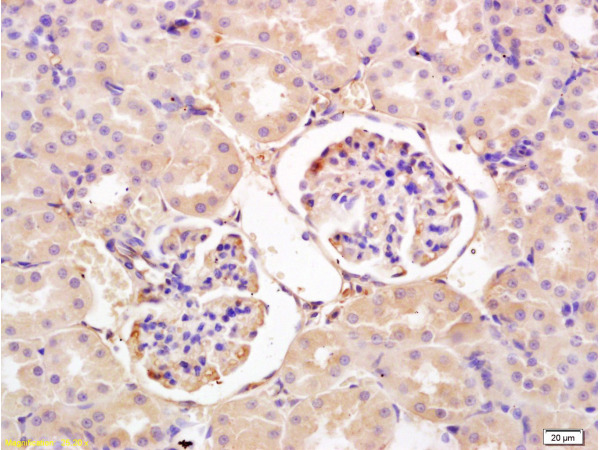 Formalin-fixed and paraffin embedded rat kidney tissue labeled with Anti-Rat IgG Polyclonal Antibody, Unconjugated (bs-0293R) at 1:600, followed by conjugation to the secondary antibody and DAB staining