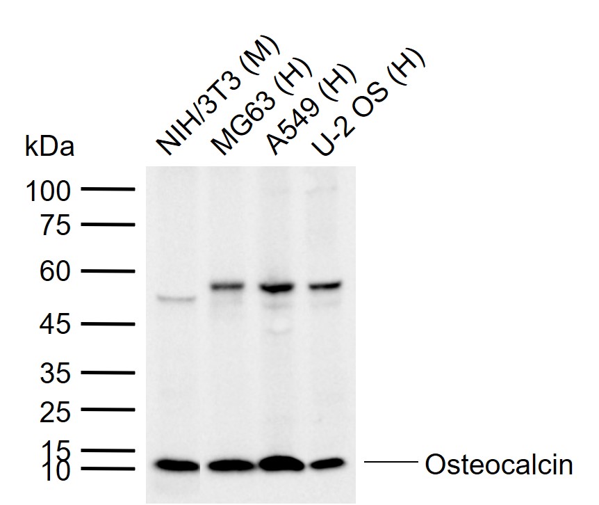 Lane 1: Mouse NIH\/3T3 cell lysates; Lane 2: Human MG63 cell lysates; Lane 3: Human A549 cell lysates; Lane 4: Human U-2 OS cell lysates probed with Osteocalcin Polyclonal Antibody, Unconjugated (bs-4917R) at 1:500 dilution and 4\u00b0C overnight incubation. Followed by conjugated secondary antibody incubation at 1:20000 for 60 min at 37˚C.