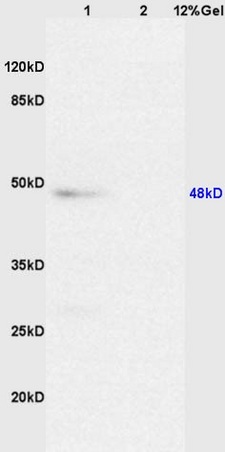 L1 mouse liver lysates L2 mouse spleen lysates probed with Anti Caspase 8 Polyclonal Antibody, Unconjugated (bs-0052R) at 1:200 overnight at 4˚C. Followed by conjugation to secondary antibody (bs-0295G-HRP) at 1:3000 for 90 min at 37˚C. Predicted band 12kD. Observed band size:48kD.\n