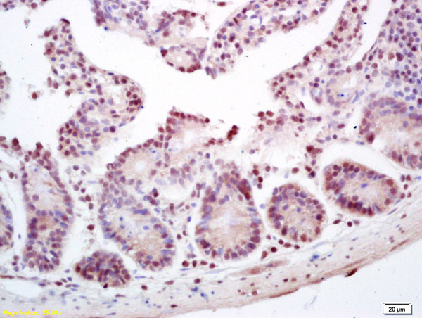 Formalin-fixed and paraffin embedded mouse intestine labeled with Anti-ZNF693/CASZ1 Polyclonal Antibody, Unconjugated (bs-5716R) at 1:200 followed by conjugation to the secondary antibody and DAB staining