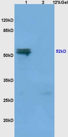 Lane 1: mouse spleen lysates Lane 2: mouse liver lysates probed with Anti MMP-3 Polyclonal Antibody, Unconjugated (bs-0413R) at 1:200 in 4˚C. Followed by conjugation to secondary antibody (bs-0295G-HRP) at 1:3000 90min in 37˚C. Predicted band 42kD,52kDkD. Observed band size: 52kD.