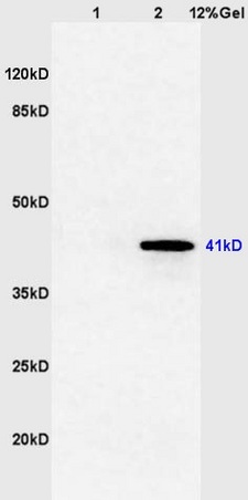 Lane 1: mouse brain lysates Lane 2: mouse thyroid lysates probed with Anti TTF-2\/FOXE1 Polyclonal Antibody, Unconjugated (bs-0446R) at 1:200 in 4˚C. Followed by conjugation to secondary antibody (bs-0295G-HRP) at 1:3000 90min in 37˚C. Predicted band 41kD. Observed band size: 41kD.