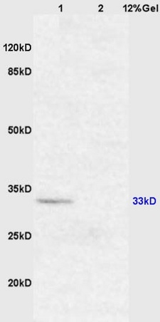 Lane 1: mouse brain lysates Lane 2: mouse intestine lysates probed with Anti XAF1/FBXO39 Polyclonal Antibody, Unconjugated (bs-1308R) at 1:200 in 4˚C. Followed by conjugation to secondary antibody (bs-0295G-HRP) at 1:3000 90min in 37˚C. Predicted band 33kD. Observed band size: 33kD.