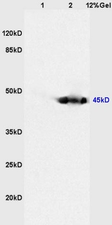 Lane 1: mouse heart lysates Lane 2: mouse kidney lysates probed with Anti CKIP-1 Polyclonal Antibody, Unconjugated (bs-1330R) at 1:200 in 4˚C. Followed by conjugation to secondary antibody (bs-0295G-HRP) at 1:3000 90min in 37˚C. Predicted band 45kD. Observed band size: 45kD. Lane 1: mouse heart lysates Lane 2: mouse kidney lysates probed with Anti CKIP-1 Polyclonal Antibody, Unconjugated (bs-1330R) at 1:200 in 4˚C. Followed by conjugation to secondary antibody (bs-0295G-HRP) at 1:3000 90min in 37˚C. Predicted band 45kD. Observed band size: 45kD.