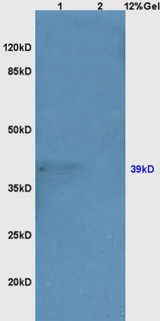 Lane 1: mouse kidney lysates Lane 2: mouse embryo lysates probed with Anti GRM1 Polyclonal Antibody, Unconjugated (bs-1803R) at 1:200 in 4˚C. Followed by conjugation to secondary antibody (bs-0295G-HRP) at 1:3000 90min in 37˚C. Predicted band 129kD. Observed band size: 129kD.