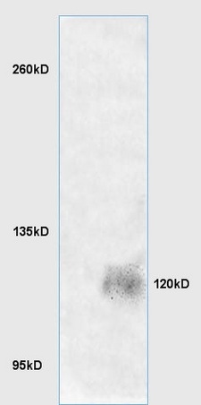 Lane 1: mouse brain lysates Lane 2: mouse embryo lysates probed with Anti LRIG1 Polyclonal Antibody, Unconjugated (bs-1844R) at 1:200 in 4˚C. Followed by conjugation to secondary antibody (bs-0295G-HRP) at 1:3000 90min in 37˚C. Predicted band 120kD. Observed band size: 120kD.