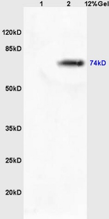 Lane 1: mouse lung lysates Lane 2: mouse brain lysates probed with Rabbit Anti-MASP2 Polyclonal Antibody, Unconjugated (bs-1980R) at 1:200 in 4˚C. Followed by conjugation to secondary antibody (bs-0295G-HRP) at 1:3000 90min in 37˚C. Predicted band 74kD. Observed band size: 74kD.