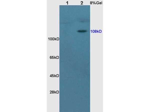Lane 1: rat brain lysates Lane 2: rat kidney lysates probed with Anti MCR Polyclonal Antibody, Unconjugated (bs-1850R) at 1:200 in 4˚C. Followed by conjugation to secondary antibody (bs-0295G-HRP) at 1:3000 90min in 37˚C. Predicted band 108kD. Observed band size: 108kD.