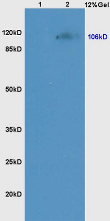 Lane 1: mouse kidney lysates Lane 2: mouse liver lysates probed with Anti NCX1/SLC8A1 Polyclonal Antibody, Unconjugated (bs-1550R) at 1:200 in 4˚C. Followed by conjugation to secondary antibody (bs-0295G-HRP) at 1:3000 90min in 37˚C. Predicted band 106kD. Observed band size: 106kD.