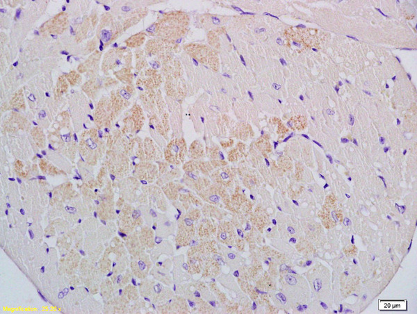 Formalin-fixed and paraffin embedded mouse heart labeled with Anti-Cyp2-j3 Polyclonal Antibody, Unconjugated (bs-2123R) at 1:200 followed by conjugation to the secondary antibody and DAB staining