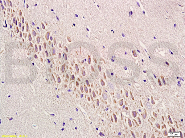 Formalin-fixed and paraffin embedded rat brain labeled with Anti-SEMA7A/CD108 Polyclonal Antibody, Unconjugated(bs-2702R) at 1:200 followed by conjugation to the secondary antibody and DAB staining
