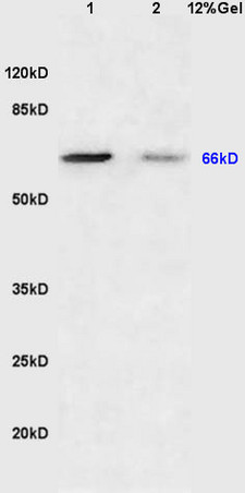 Lane 1: mouse brain lysates Lane 2: mouse lung lysates probed with Anti Sema7A/CD108 Polyclonal Antibody, Unconjugated (bs-2702R) at 1:200 in 4˚C. Followed by conjugation to secondary antibody (bs-0295G-HRP) at 1:3000 90min in 37˚C. Predicted band 66kD. Observed band size: 66kD.