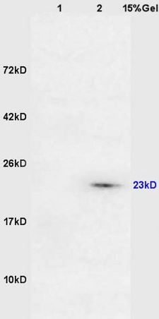 Lane 1: mouse lung lysates Lane 2: mouse intestine lysates probed with Anti DARPP32 Polyclonal Antibody, Unconjugated (bs-2762R) at 1:200 in 4˚C. Followed by conjugation to secondary antibody (bs-0295G-HRP) at 1:3000 90min in 37˚C. Predicted band 23kD. Observed band size: 23kD.