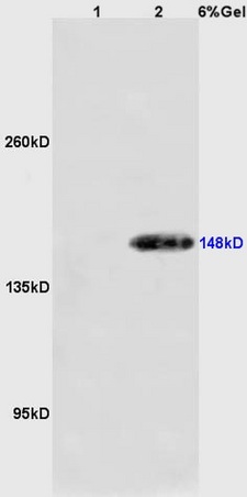 Lane 1: mouse stomach lysates Lane 2: mouse pancreas lysates probed with Anti GRM1 Polyclonal Antibody, Unconjugated (bs-1803R) at 1:200 in 4˚C. Followed by conjugation to secondary antibody (bs-0295G-HRP) at 1:3000 90min in 37˚C. Predicted band 148kD. Observed band size: 148kD.