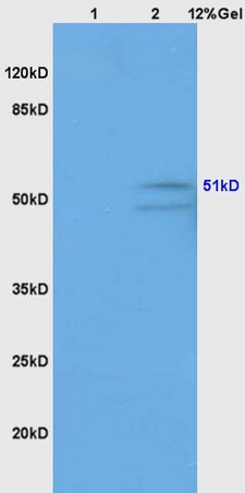 Lane 1: human colon carcinoma lysates Lane 2: mouse brain lysates probed with Anti GABRG2/GABA A Receptor gamma 2 Polyclonal Antibody, Unconjugated (bs-4112R) at 1:200 in 4˚C. Followed by conjugation to secondary antibody (bs-0295G-HRP) at 1:3000 90min in 37˚C. Predicted band 51kD. Observed band size: 51kD.