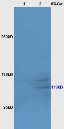 Lane 1: mouse liver lysates Lane 2: mouse brain lysates probed with Anti Bub1 Polyclonal Antibody, Unconjugated (bs-4294R) at 1:200 in 4˚C. Followed by conjugation to secondary antibody (bs-0295G-HRP) at 1:3000 90min in 37˚C. Predicted band 119kD. Observed band size: 119kD.