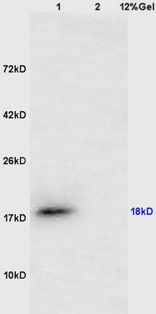 Lane 1: mouse testis lysates Lane 2: mouse lung lysates probed with Anti CTAG1B/Cancer/testis antigen 1 Polyclonal Antibody, Unconjugated (bs-4503R) at 1:200 in 4˚C. Followed by conjugation to secondary antibody (bs-0295G-HRP) at 1:3000 90min in 37˚C. Predicted band 18kD. Observed band size: 18kD.