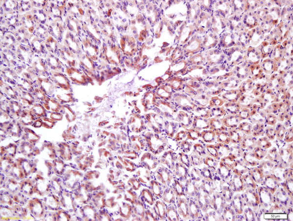 Formalin-fixed and paraffin embedded mouse stomach labeled with Anti-Calponin 1\/COLP Polyclonal Antibody, Unconjugated (bs-0095R) at 1:200 followed by conjugation to the secondary antibody and DAB staining