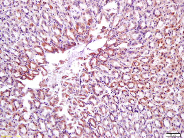 Formalin-fixed and paraffin embedded mouse stomach labeled with Anti-Calponin 1/COLP Polyclonal Antibody, Unconjugated (bs-0095R) at 1:200 followed by conjugation to the secondary antibody and DAB staining