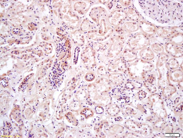 Formalin-fixed and paraffin embedded human kidney labeled with Anti-PRKAA2/AMPK alpha 2 Polyclonal Antibody, Unconjugated (bs-2771R) at 1:200 followed by conjugation to the secondary antibody and DAB staining