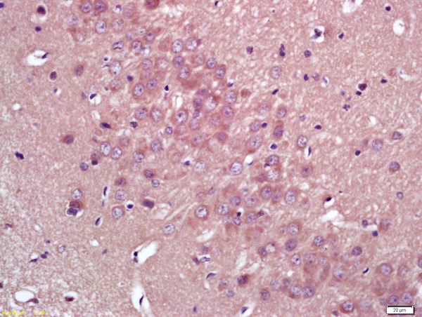Formalin-fixed and paraffin embedded rat brain labeled with Anti-HMGCR Polyclonal Antibody, Unconjugated (bs-5068R) at 1:200 followed by conjugation to the secondary antibody and DAB staining