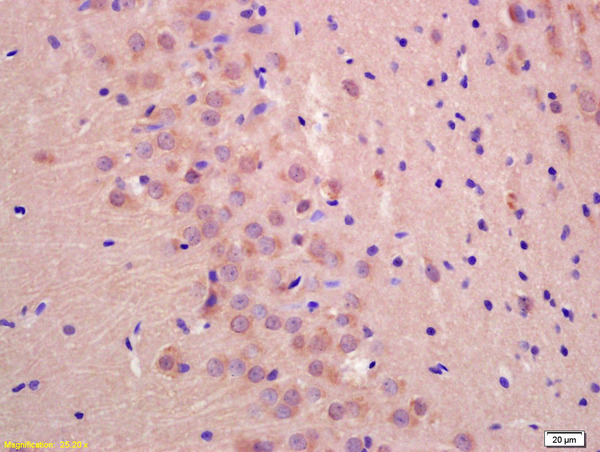 Formalin-fixed and paraffin embedded rat brain labeled with Anti-UBXD2 Polyclonal Antibody, Unconjugated (bs-11675R) at 1:200 followed by conjugation to the secondary antibody and DAB staining