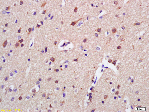 Formalin-fixed and paraffin embedded rat brain labeled with Anti-AKAP7 Polyclonal Antibody, Unconjugated (bs-11999R) at 1:200 followed by conjugation to the secondary antibody and DAB staining
