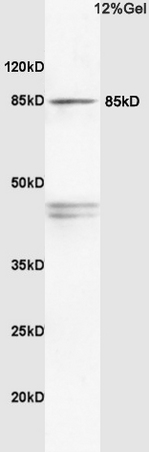 Rat brain lysates probed with Anti PI3K/PI3 kinase p85 alpha subunit Polyclonal Antibody, Unconjugated (bs-0128R) at 1:200 in 4˚C. Followed by conjugation to secondary antibody (bs-0295G-HRP) at 1:3000 90min in 37˚C. Predicted band 80kD. Observed band size: 85kD.