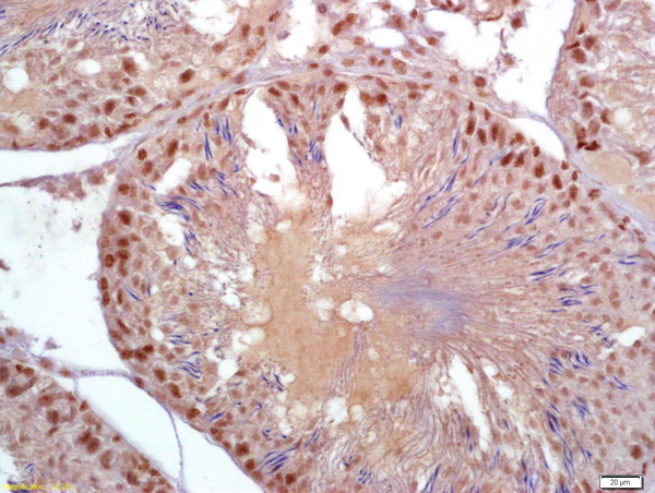 Formalin-fixed and paraffin embedded rat testis labeled with Anti-Parkin protein/PARK2 Polyclonal Antibody, Unconjugated (bs-1865R) at 1:200 followed by conjugation to the secondary antibody and DAB staining