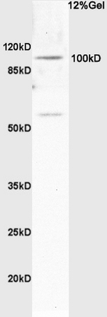 Rat brain lysates probed with Anti Synphilin-1 Polyclonal Antibody, Unconjugated (bs-1905R) at 1:200 in 4˚C. Followed by conjugation to secondary antibody (bs-0295G-HRP) at 1:3000 90min in 37˚C. Predicted band 100kD. Observed band size:60kD 100kD.