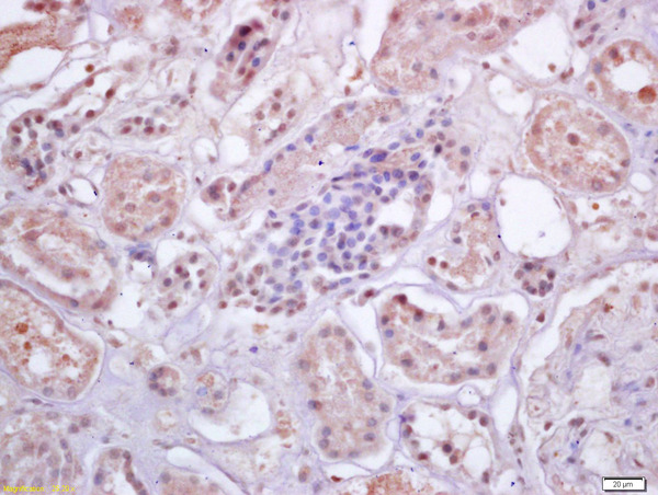 Formalin-fixed and paraffin embedded human kidney labeled with Anti-IRF3 Polyclonal Antibody, Unconjugated (bs-2993R) at 1:200 followed by conjugation to the secondary antibody and DAB staining