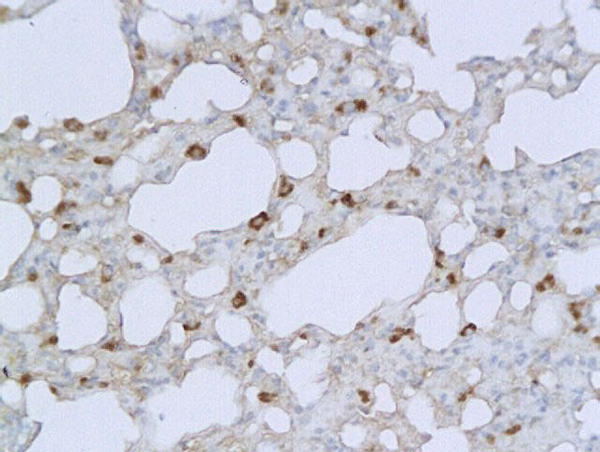 Formalin-fixed and paraffin embedded mouse lung labeled with  (bs-0812R) Rabbit Anti-IL-1 Beta\/IL-1B Polyclonal Antibody, Unconjugated followed by conjugation to the secondary antibody and DAB staining.