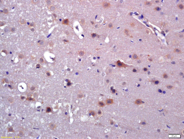 Formalin-fixed and paraffin embedded rat brain labeled with Anti-ABAT Polyclonal Antibody, Unconjugated (bs-4234R) at 1:200 followed by conjugation to the secondary antibody and DAB staining