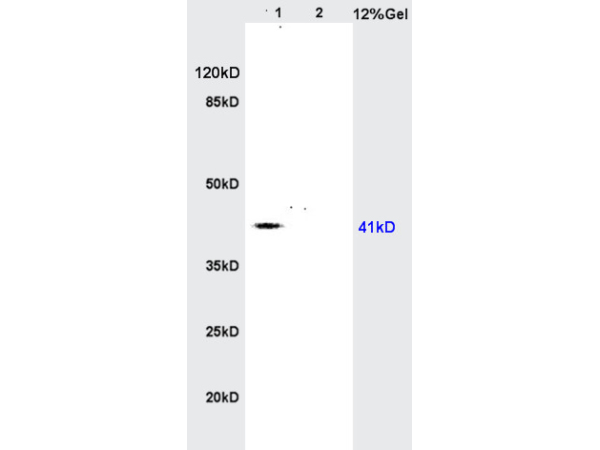 Lane 1: rat brain lysates Lane 2: rat heart lysates probed with Anti AGPAT4 Polyclonal Antibody, Unconjugated (bs-5033R) at 1:200 in 4˚C. Followed by conjugation to secondary antibody (bs-0295G-HRP) at 1:3000 90min in 37˚C. Predicted band 41kD. Observed band size: 41kD.