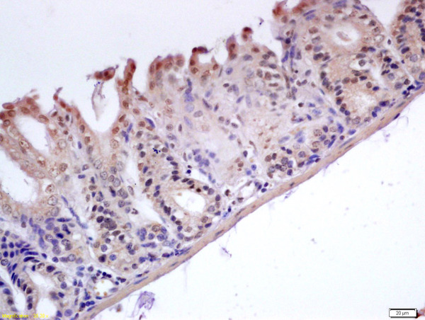 Formalin-fixed and paraffin embedded mouse stomach labeled with Anti-GADD45B Polyclonal Antibody, Unconjugated (bs-5904R) at 1:200 followed by conjugation to the secondary antibody and DAB staining