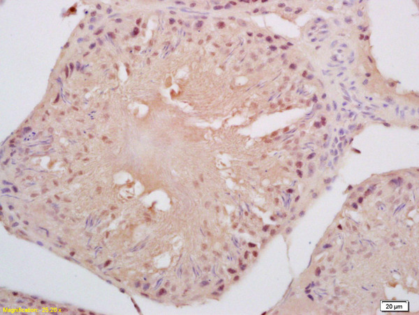 Formalin-fixed and paraffin embedded rat testis labeled with Anti-Cyclin B3 Polyclonal Antibody, Unconjugated (bs-7884R) at 1:200 followed by conjugation to the secondary antibody and DAB staining
