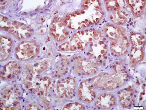 Formalin-fixed and paraffin embedded human kidney labeled with Anti-TXNRD1 Polyclonal Antibody, Unconjugated (bs-8299R) at 1:200 followed by conjugation to the secondary antibody and DAB staining