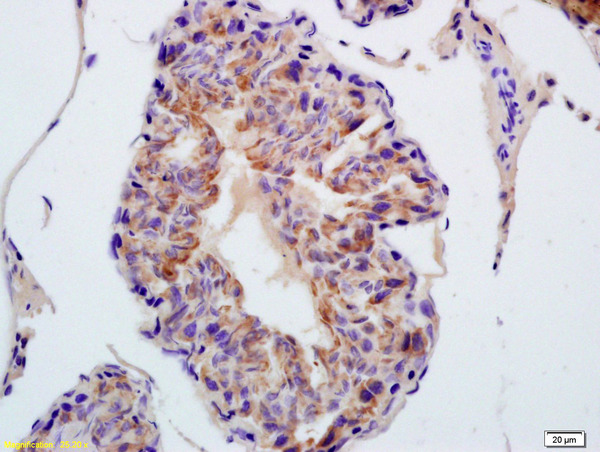 Formalin-fixed and paraffin embedded rat testis labeled with Anti-TXNRD1 Polyclonal Antibody, Unconjugated (bs-8299R) at 1:200 followed by conjugation to the secondary antibody and DAB staining
