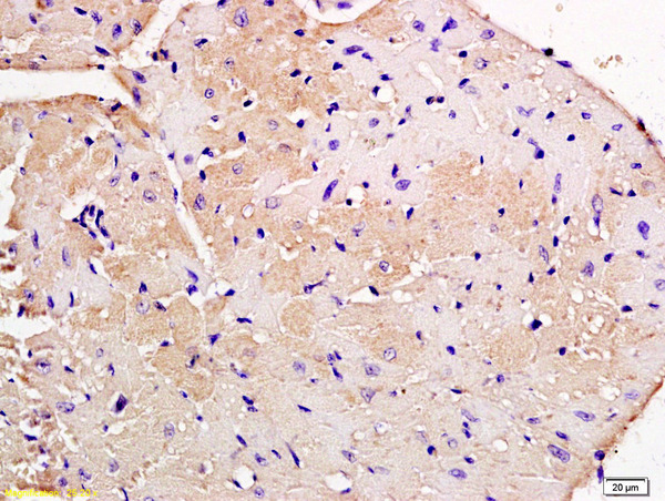 Formalin-fixed and paraffin embedded mouse heart tissue labeled with Anti-Nebulette Polyclonal Antibody, Unconjugated (bs-9468R) at 1:200 followed by conjugation to the secondary antibody and DAB staining