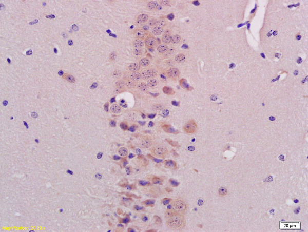 Formalin-fixed and paraffin embedded mouse brain labeled with Anti-BHLHB9/p60TRP Polyclonal Antibody, Unconjugated (bs-11653R) at 1:200 followed by conjugation to the secondary antibody and DAB staining