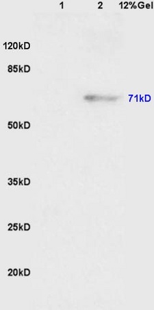 Lane 1: mouse embryo lysates Lane 2: mouse pancreas lysates probed with Anti Phospho-Wee1(Ser123)Polyclonal Antibody, Unconjugated (bs-5218R) at 1:200 in 4˚C. Followed by conjugation to secondary antibody (bs-0295G-HRP) at 1:3000 90min in 37˚C. Predicted band 71kD. Observed band size: 71kD.