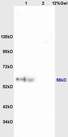 Lane 1: mouse brain lysates Lane 2: mouse heart lysates probed with Anti phospho-RPS6KB1(Ser427)Polyclonal Antibody, Unconjugated (bs-5670R) at 1:200 in 4˚C. Followed by conjugation to secondary antibody (bs-0295G-HRP) at 1:3000 90min in 37˚C. Predicted band 58kD. Observed band size: 58kD.