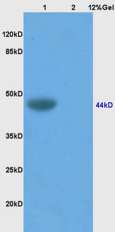 Lane 1: mouse brain lysates Lane 2: human colon carcinoma lysates probed with Anti SynCAM/TSLC1 Polyclonal Antibody, Unconjugated (bs-6026R) at 1:200 in 4˚C. Followed by conjugation to secondary antibody (bs-0295G-HRP) at 1:3000 90min in 37˚C. Predicted band 44kD. Observed band size: 44kD.
