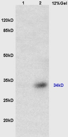 Lane 1: mouse brain lysates Lane 2: mouse heart lysates probed with Anti TUSC3 Polyclonal Antibody, Unconjugated (bs-6115R) at 1:200 in 4˚C. Followed by conjugation to secondary antibody (bs-0295G-HRP) at 1:3000 90min in 37˚C. Predicted band 34kD. Observed band size: 34kD.