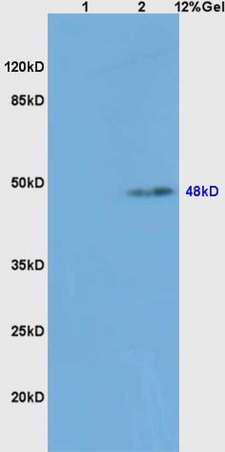 Lane 1: mouse spleen lysates Lane 2: mouse liver lysates probed with Anti caspase-8 subunit p18 Polyclonal Antibody, Unconjugated (bs-6463R) at 1:200 in 4˚C. Followed by conjugation to secondary antibody (bs-0295G-HRP) at 1:3000 90min in 37˚C. Predicted band 18kD,48kD. Observed band size: 48kD.