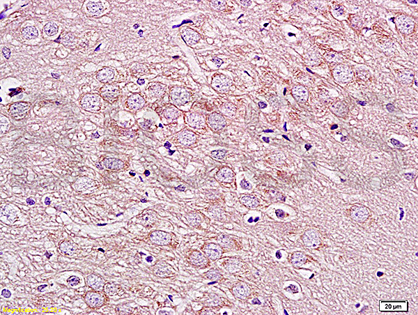 Formalin-fixed and paraffin embedded rat brain labeled with  Rabbit Anti GPRIN1 Polyclonal Antibody, Unconjugated (bs-8275R) at 1:200 followed by conjugation to the secondary antibody and DAB staining